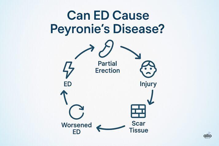 infographic explaining how erectile dysfunction can contribute to Peyronie’s disease through a cycle — partial erection, injury, scar tissue formation, and worsening ED.