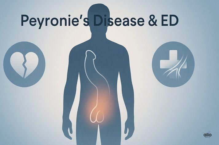 Peyronie’s Disease and Erectile Dysfunction: Link and Effects on Sexual Health