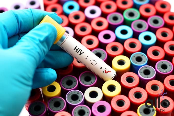 What Is HIV Wasting Syndrome? Can HIV Kill You?, testing and diagnosis of HIV in hindi