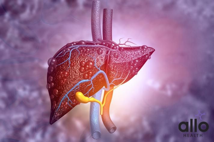 हेपेटाइटिस C की परेशानी