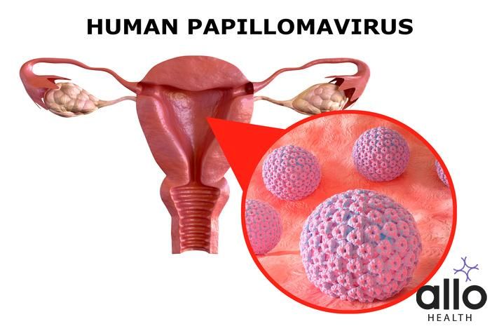 HPV cervical cancer What is Human Papillomavirus (HPV)?