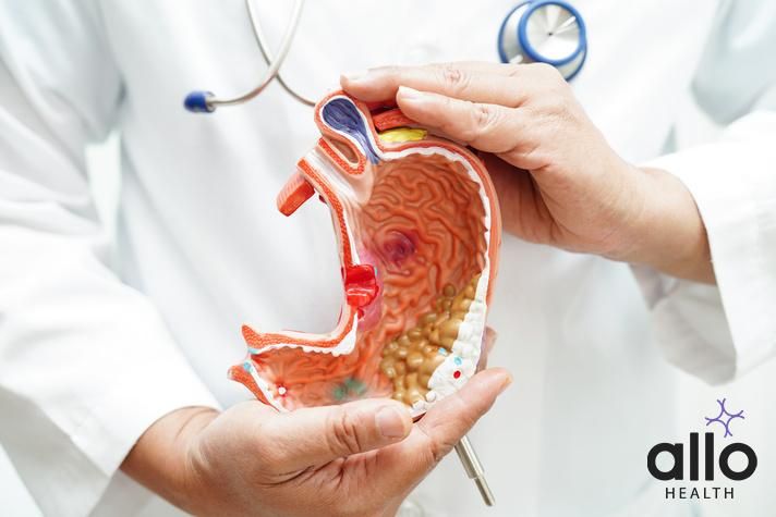 Stomach disease, doctor holding anatomy model for study diagnosis and treatment in hospital., Managing Pelvic Inflammatory Disease (PID): Coping and Psychological Support