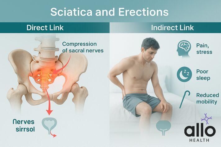 Infographic comparing direct nerve compression and indirect effects like stress, poor sleep, and reduced mobility on erections, illustrating can sciatica cause erectile dysfunction.