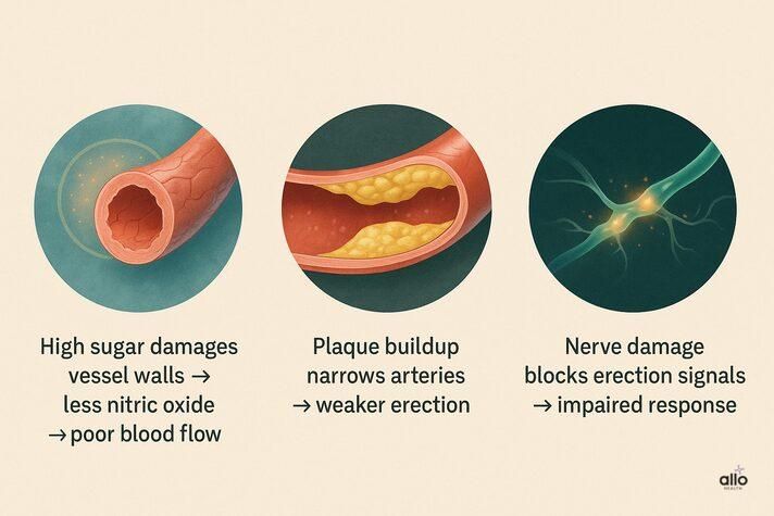 Medical infographic illustrating does metformin cause erectile dysfunction compared to diabetes effects, showing blood vessel damage, plaque buildup, and nerve damage pathways.