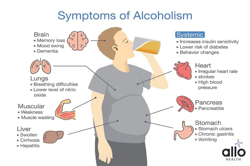 Symptom of alcoholism patient. Illustration about health problem of people with alcohol addiction.