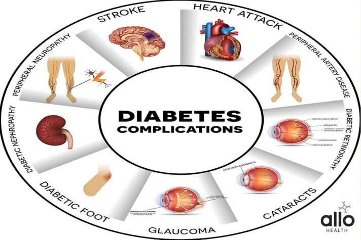 Char showing all the Complications with Diabetes